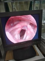 phu kien noi soi tai mui hong (3).jpg