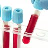 Ý nghĩa và giá trị lâm sàng các chỉ số sinh hóa máu thường quy
